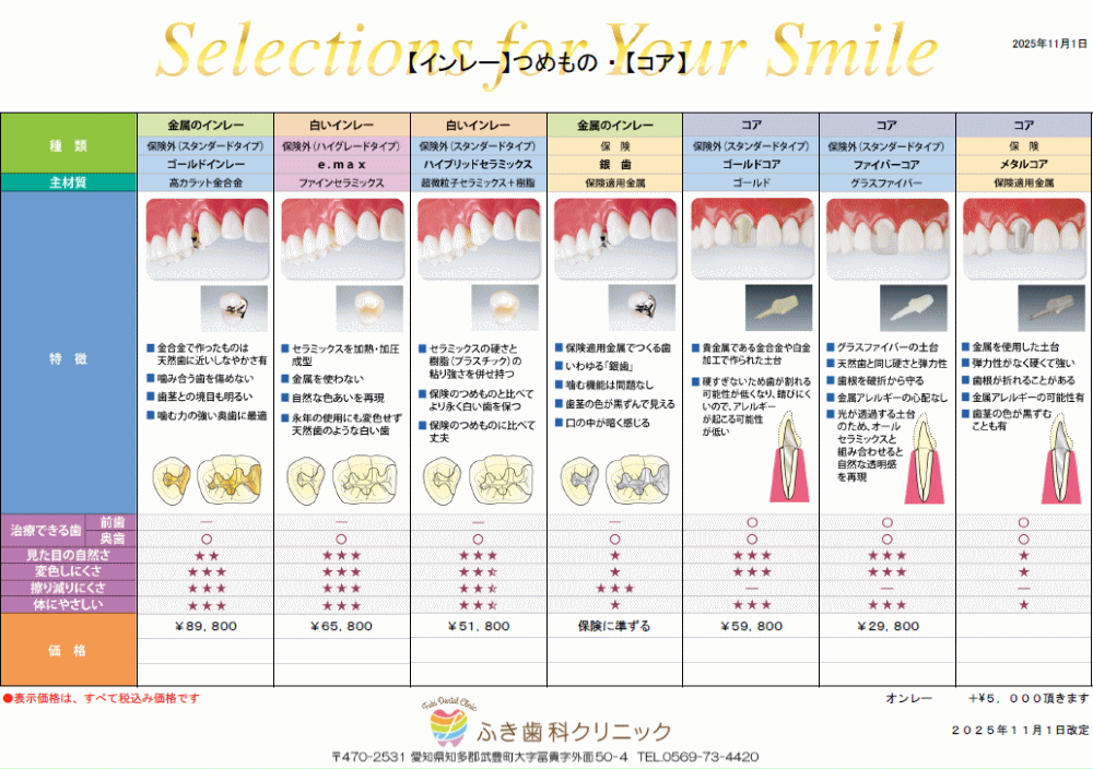 インレー（つめもの）