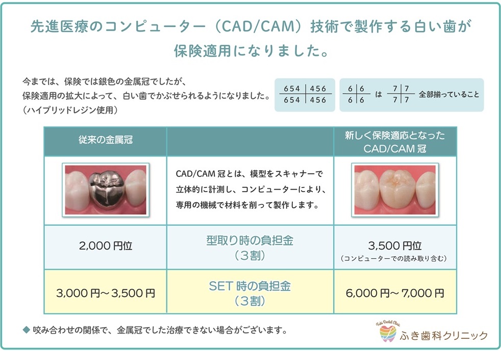 先進医療のコンピューター（CAD CAM）技術で製作する白い歯が、保険適応