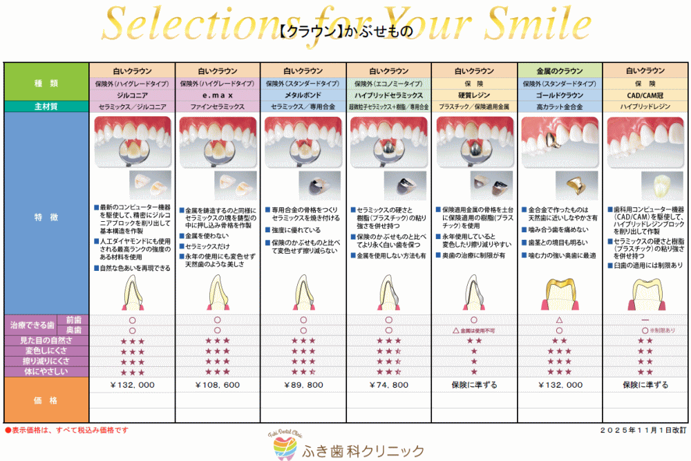クラウン(かぶせもの)のメニュー